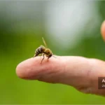 نیش زدگی زنبور عسل